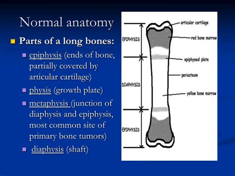 Ppt Musculoskeletal Block Pathology Lecture 1 Fracture