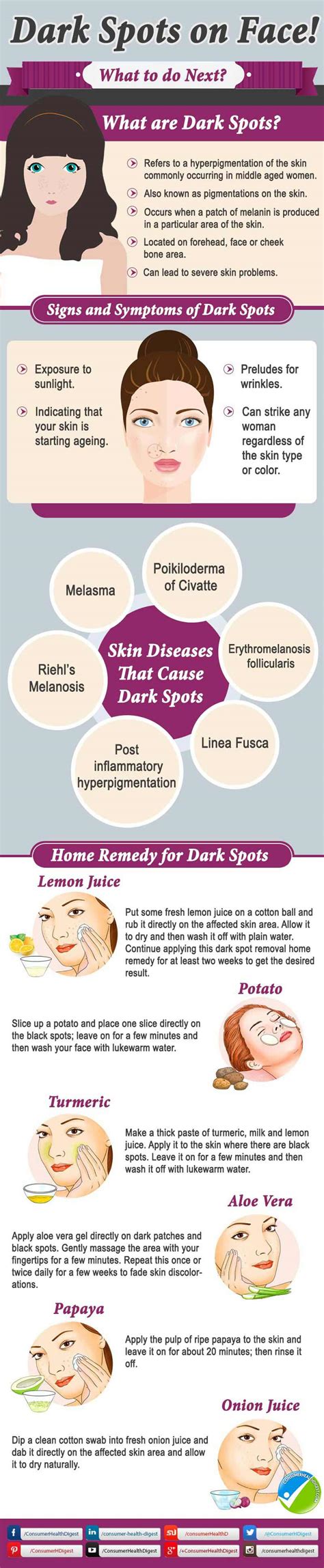 Dark Spots On Face Causes And Treatments