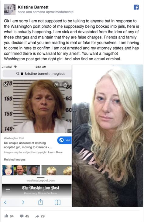 Real Life Esther (Orphan)?