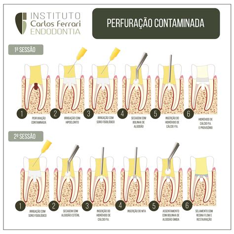 Cid Perfuração Com Agulha Contaminada