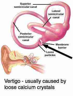 The utricle is a nearby part of the ear. Vertigo dizziness can turn you upside down but there is a ...