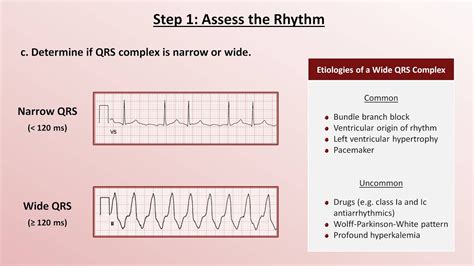 Intro To Ekg Interpretation A Systematic Approach Youtube