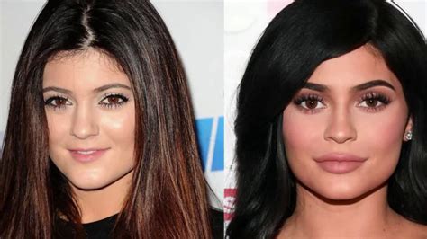 KYLIE JENNER Before After Transformation YouTube
