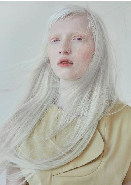 Nastya Zhidkova 2019 02 27 Albino Girl Aesthetic People Albinism