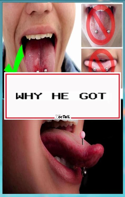 Slip Of The Tongue 5 Signs Of A Tongue Piercing Infection Why He Got 2