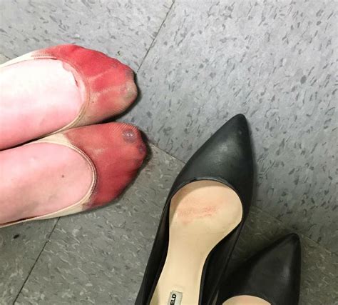 Waitress Forced To Wear High Heels At Work Shares Photo Of Her Bleeding Feet The Independent
