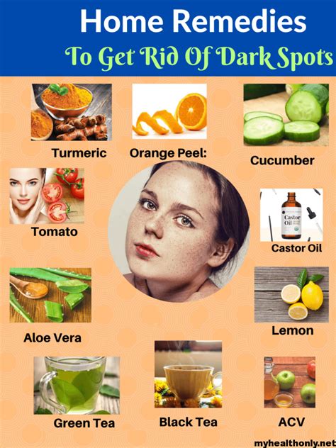 21 Top Home Remedies For Dark Spots You Must Know My Health Only