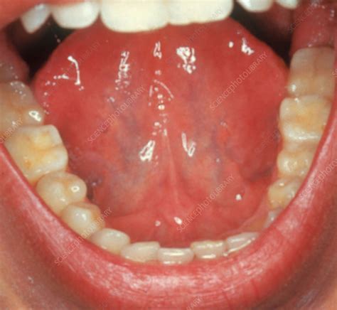 Mouth Stock Image C0219650 Science Photo Library