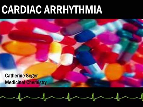 Ppt Cardiac Arrhythmia Powerpoint Presentation Free Download Id503454