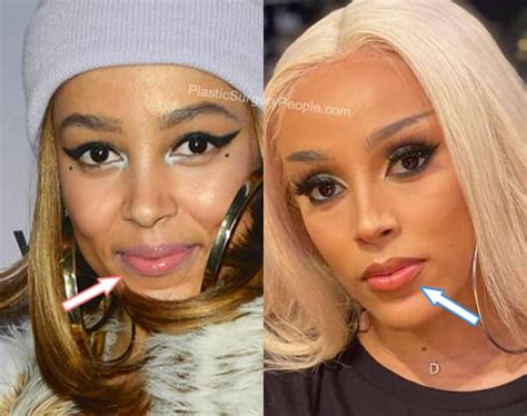 Doja Cat Before And After 2022