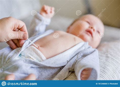 Treatment Of Newborn Baby Navel With A Cotton Swab Stock Image Image