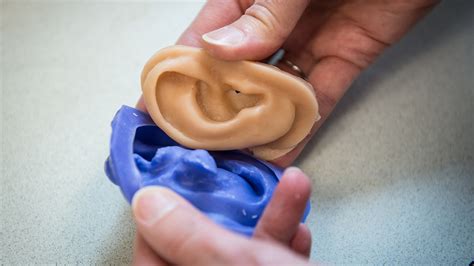 How Facial Prosthetics Are Made Using 3 D Printing
