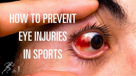 How To Prevent Eye Injuries In Sports And Exercise Youtube