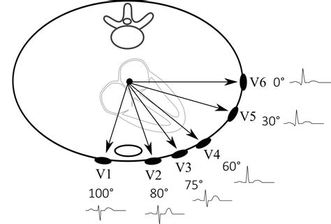 Electrocardiogram Guide Ekgecg Stepwards