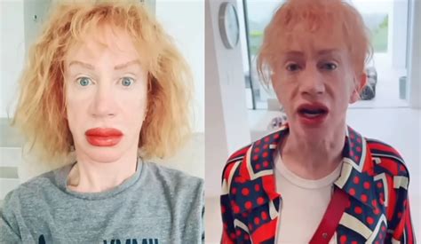 Yikes Kathy Griffin Shocks Fans With Red Swollen Lips After
