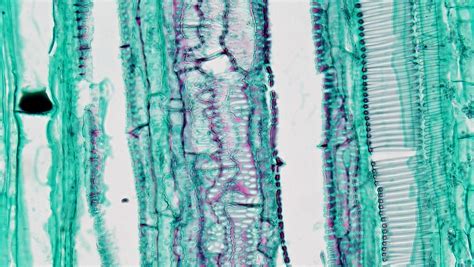 Herbaceous Dicot Stem Tangential Section Xylem Elements I Flickr