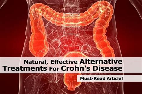 Natural Effective Alternative Treatments For Crohns Disease