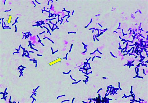 Gram Positive Rods At 1000 X Magnification From A Blood Culture Bottle