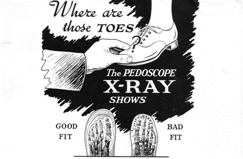 History X Ray Shoe Fitting Machine