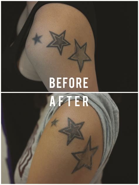 Becoming a tattoo artist is getting increasingly popular these days especially because of websites that sell extremely cheap tattoo kits, reliable tattoo machines, tattoo inks, tattoo designs and more. To rub out the stars: Quick, cheap, but not pain-free ...