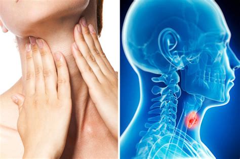 Visible Signs Of Throat Cancer Sexiz Pix