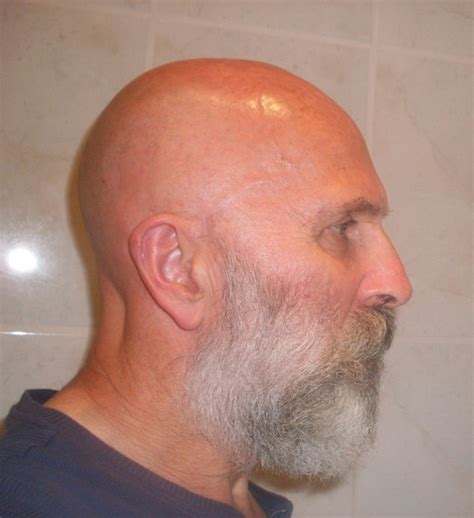 Beard Bald Head Shaved Head Or Buzzcut Page 34 Beard Board