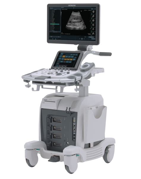 Ultrasound System