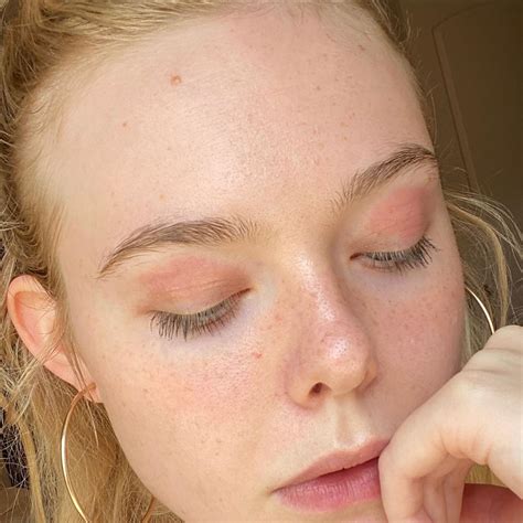 Elle Fanning Shares Selfie Of Eczema On Her Face