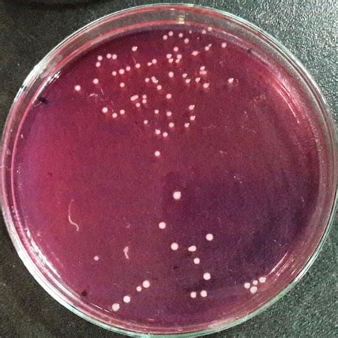 Staphylococcus Culture Plate On Mannitol Salt Agar Download