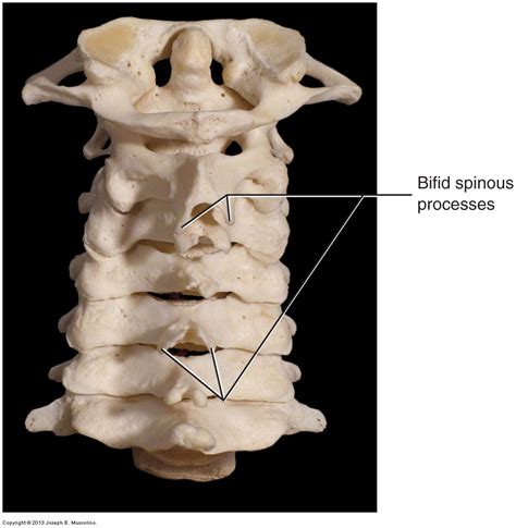 Introduction To Overview Of The Cervical Spine Of The Neck