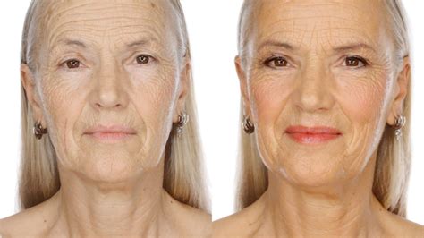 Возрастные изменения кожи у женщин после 60 фото с названиями