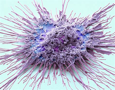 Dendritic Cell Photograph By Steve Gschmeissner Pixels