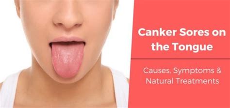 It may grow inside the lips or on the cheek portion. Oral Health Articles | Daily Health Cures