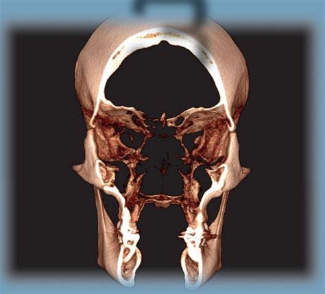 3 Anatomic Structures Pocket Dentistry