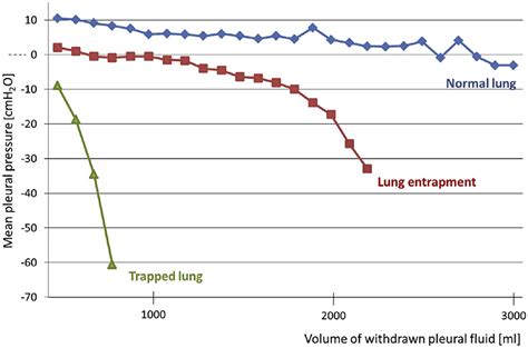 Learn about the symptoms & causes of pleural effusions and pleural mesothelioma. Loculated Pleural Effusion Diagram - Chest Radiograph ...