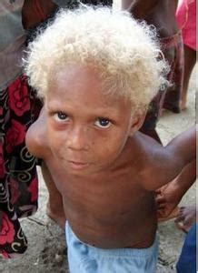 It evolved independently in melanesia where melanesians of some islands. Minor genetic quirk causes Melanesian Solomon people's ...