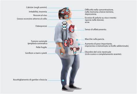 L'aspetto della patologia genetica nei bambini, di regola, diventa una sorpresa completa per i genitori che non hanno tali deviazioni nella salute. Sindrome di Cushing: come diagnosticarla, sintomi e cura