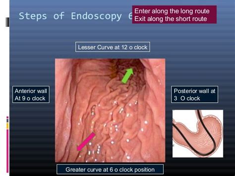 Steps Of Diagnostic Endoscopy