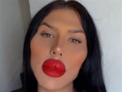 Model Sofia Reveals Says She S Had Over Injections To Get Biggest Lips In The World