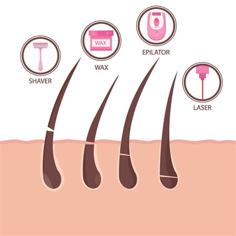 5 Questions To Ask Before Getting Laser Hair Removal Louisville Laser