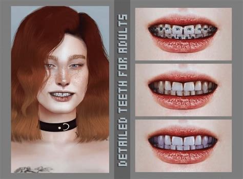 Sims 4 Teeth Replacement