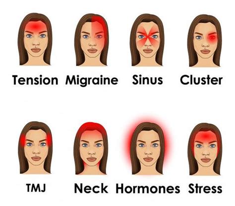 Headache Chart What Does Headache Location Mean