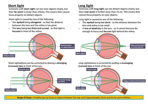 Gcse Physics Long Sight And Short Sight Poster Teaching Resources