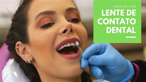 Já ouviu falar de lente de contato dental Conheça esta técnica