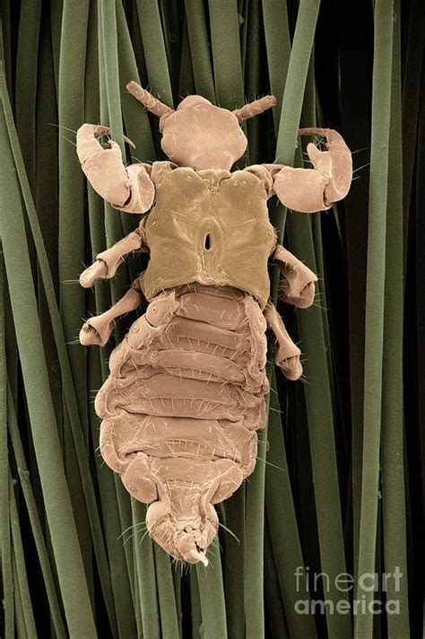 Head Louse Clinging To Human Hair Photograph By Dr Jeremy Burgess