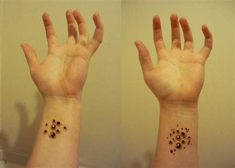 Trypophobia Skin Disease Real