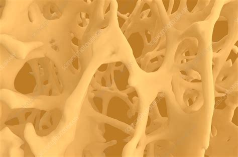 Osteoporotic Bone Tissue Illustration Stock Image F0389858
