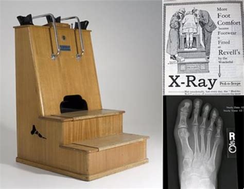 History Of X Rays 125 Years In The Making Pt 1 Excillum
