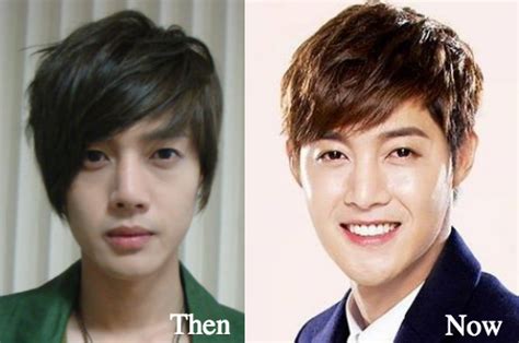 Kim Hyun Joong Plastic Surgery Before And After Photos Latest Plastic