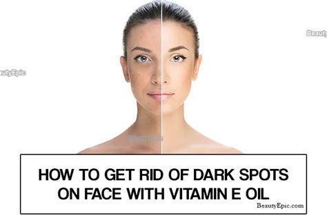 How To Use Vitamin E Oil For Dark Spots On Face